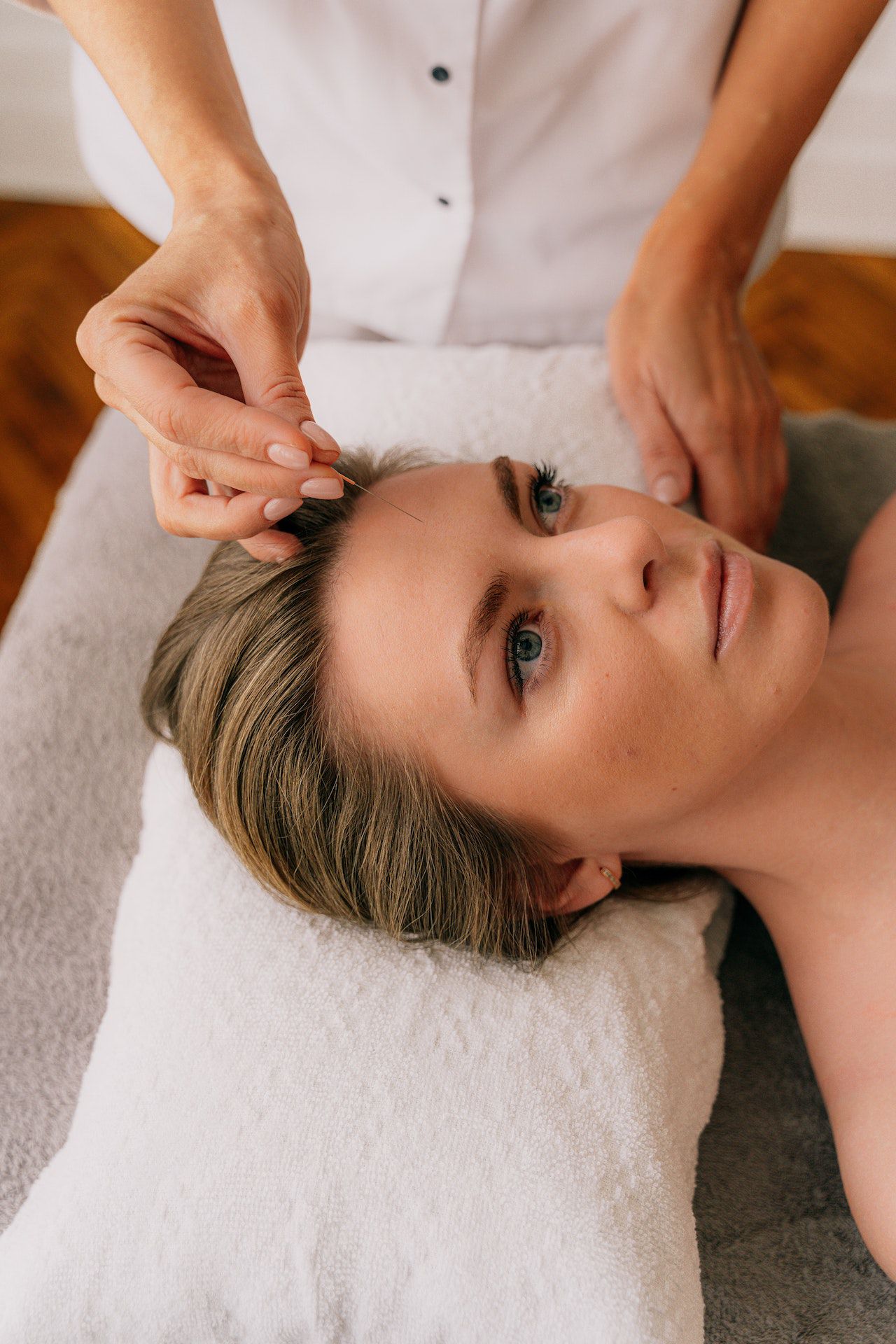 Acupuntura facial