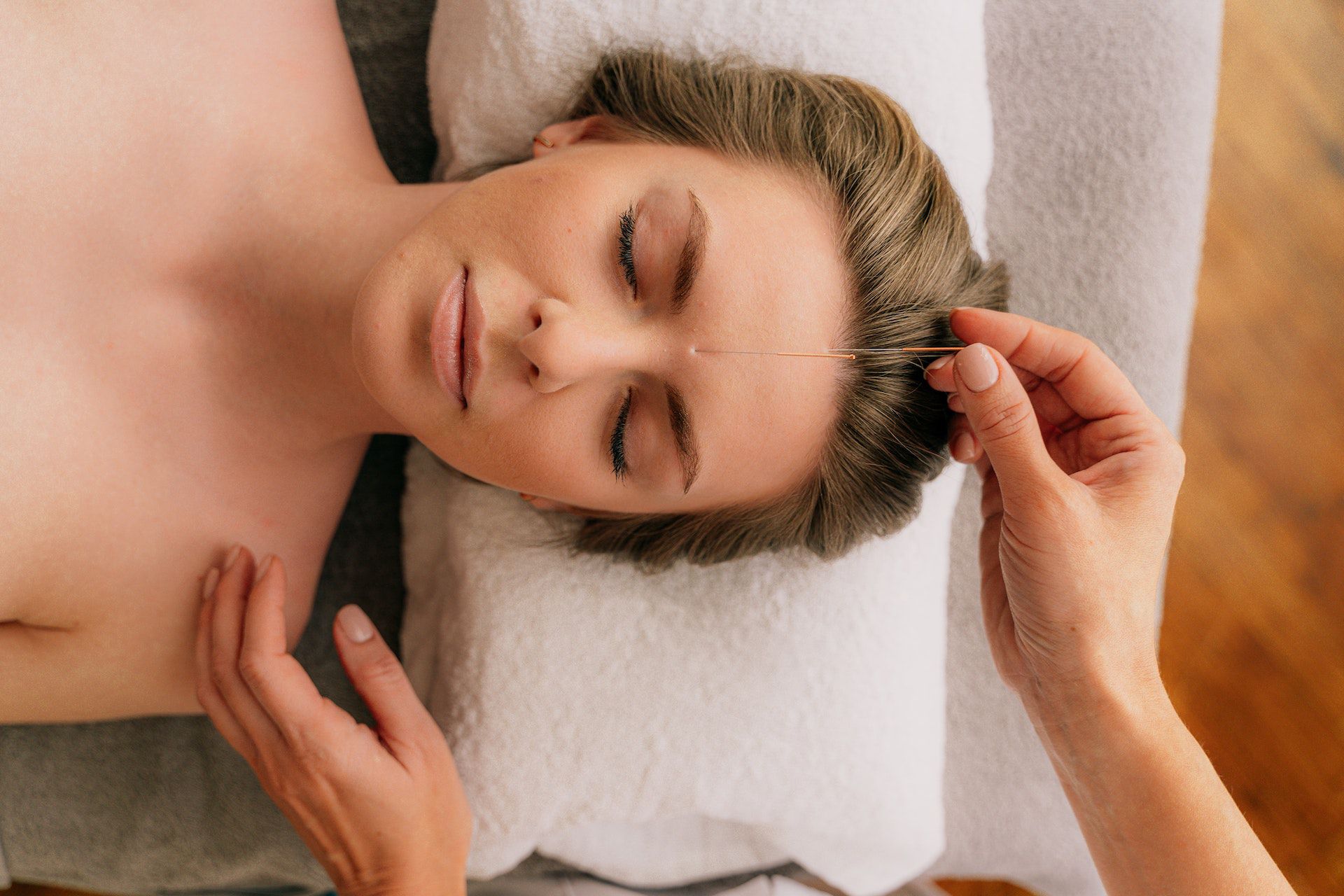 Acupuntura facial