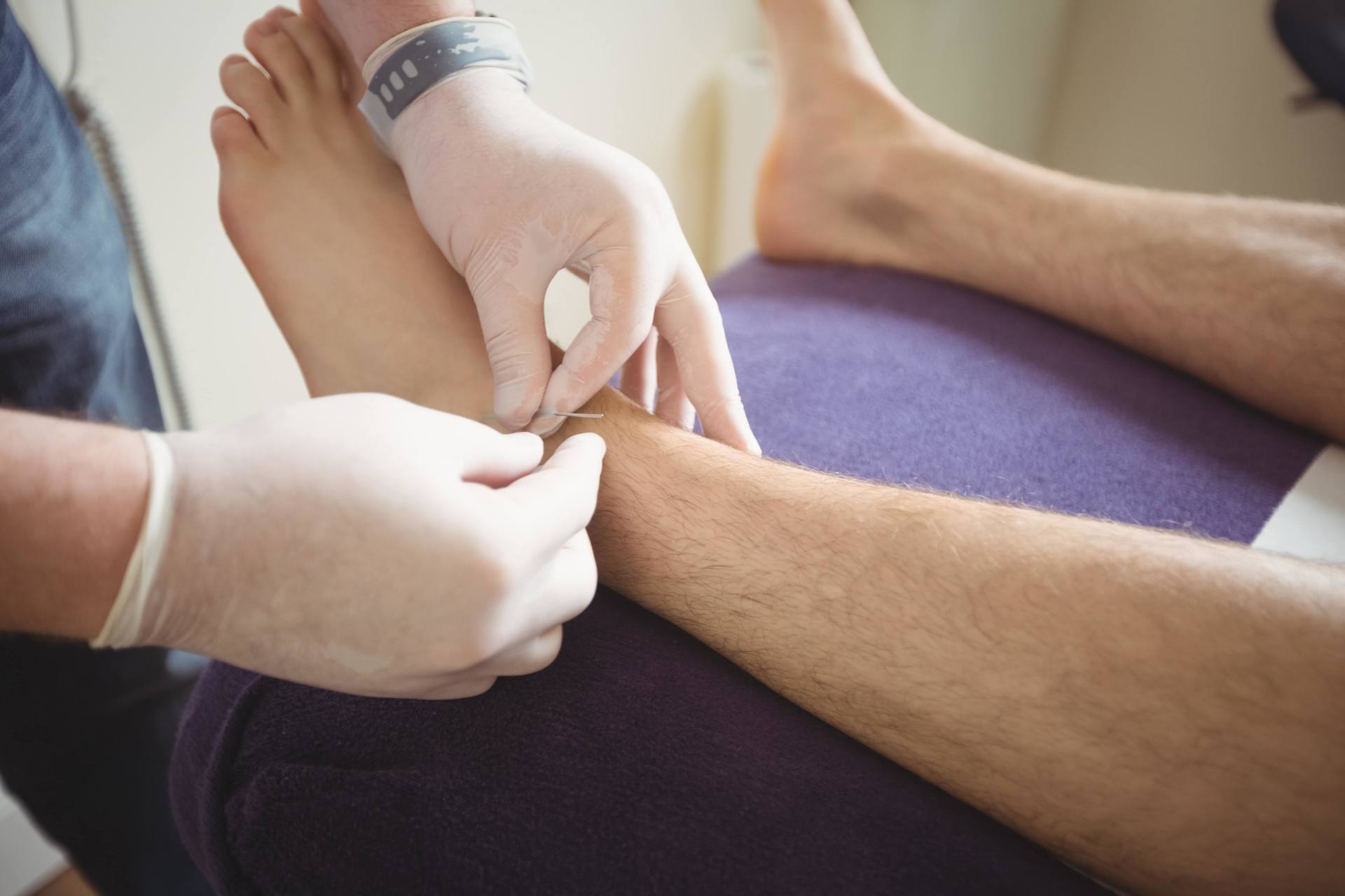 Acupuntura zonal en tobillos