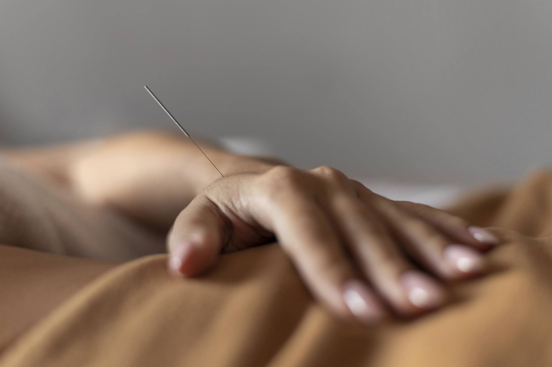 acupuntura zonal muñeca